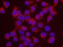 Menin Antibody, Novus Biologicals 0.1mg; Unlabeled:Antibodies, Polyclonal