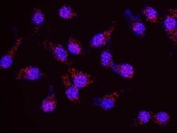 Menin Antibody, Novus Biologicals 0.1mg; Unlabeled:Antibodies, Polyclonal