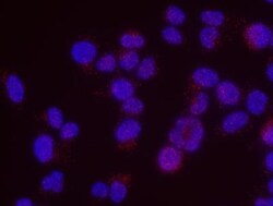 Menin Antibody, Novus Biologicals 0.1mg; Unlabeled:Antibodies, Polyclonal