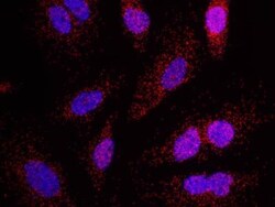 Menin Antibody, Novus Biologicals 0.1mg; Unlabeled:Antibodies, Polyclonal