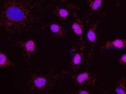 Menin Antibody, Novus Biologicals 0.1mg; Unlabeled:Antibodies, Polyclonal