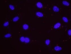 Menin Antibody, Novus Biologicals 0.1mg; Unlabeled:Antibodies, Polyclonal