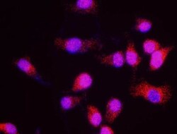 Menin Antibody, Novus Biologicals 0.1mg; Unlabeled:Antibodies, Polyclonal