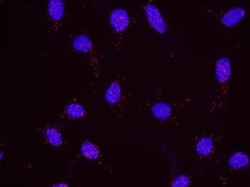 Menin Antibody, Novus Biologicals 0.1mg; Unlabeled:Antibodies, Polyclonal