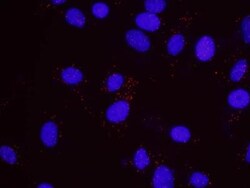 Menin Antibody, Novus Biologicals 0.1mg; Unlabeled:Antibodies, Polyclonal
