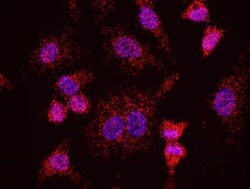 Menin Antibody, Novus Biologicals 0.1mg; Unlabeled:Antibodies, Polyclonal