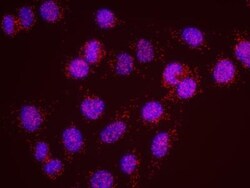Menin Antibody, Novus Biologicals 0.1mg; Unlabeled:Antibodies, Polyclonal