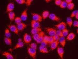Menin Antibody, Novus Biologicals 0.1mg; Unlabeled:Antibodies, Polyclonal