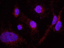 Menin Antibody, Novus Biologicals 0.1mg; Unlabeled:Antibodies, Polyclonal