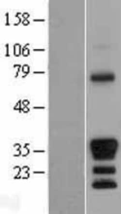 Novus Biologicals&trade;&nbsp;MEOX 2 Overexpression Lysate