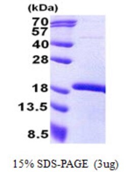 Novus Biologicals&trade;&nbsp;Recombinant Human MEOX 2 His Protein
