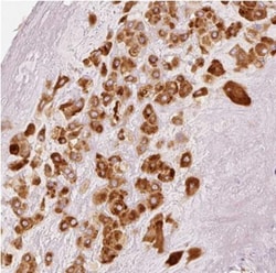 MEOX 2 Antibody, Novus Biologicals 0.1mL; Unlabeled:Antibodies, Polyclonal