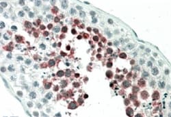 MEPCE Antibody, Novus Biologicals 0.1mg; Unlabeled:Antibodies, Polyclonal