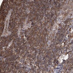 MEPE/OF45 Antibody, Novus Biologicals 0.1mL; Unlabeled:Antibodies, Polyclonal