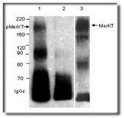 Mer, p Tyr754, p Tyr749, p Tyr753 Antibody, Novus Biologicals 0.1mg; Unlabeled:Antibodies,