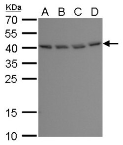 MERIT40/HSPC142 Antibody (1251), Novus Biologicals 0.1mL; Unlabeled:Antibodies,