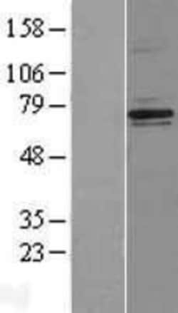 Novus Biologicals&trade;&nbsp;NF2/Merlin Overexpression Lysate