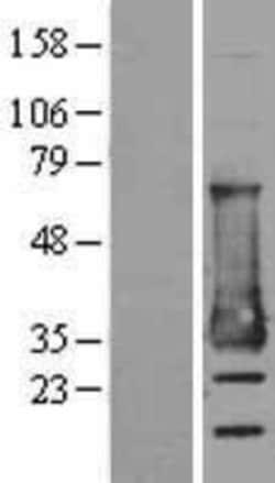 Novus Biologicals&trade;&nbsp;MESDC2 Overexpression Lysate