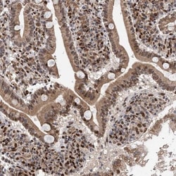 MESDC2 Antibody, Novus Biologicals 0.1mL; Unlabeled:Antibodies, Polyclonal