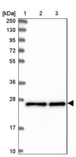 MESDC2 Antibody, Novus Biologicals 0.1mL; Unlabeled:Antibodies, Polyclonal