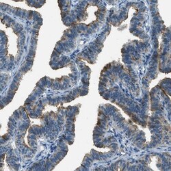 Mesothelin Antibody, Novus Biologicals 25 &mu;L | Buy Online | Novus Biologicals | Fisher Scientific