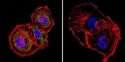 Mesothelioma Antibody (ME1) - BSA Free, Novus Biologicals 0.025mg; Unlabeled:Antibodies,