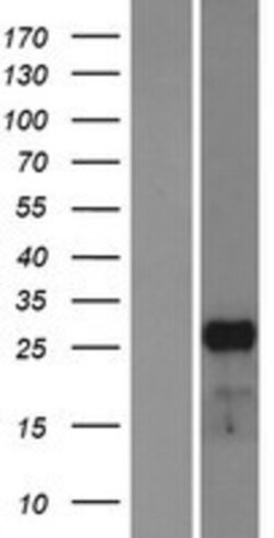 Novus Biologicals&trade;&nbsp;Mesp1 Overexpression Lysate