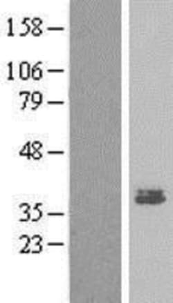 Novus Biologicals™ MEST Overexpression Lysate