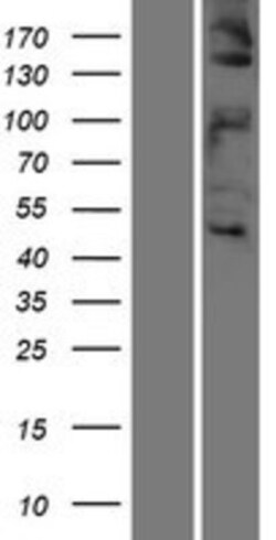 Novus Biologicals&trade;&nbsp;HGFR/c-MET Overexpression Lysate
