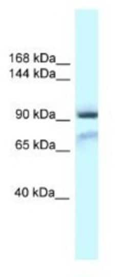 GluR1 Antibody, Novus Biologicals 100&mu;L; Unlabeled:Antibodies, Polyclonal