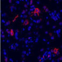 mGluR1 Antibody - BSA Free, Novus Biologicals 0.1 mg; Unconjugated:Antibodies,