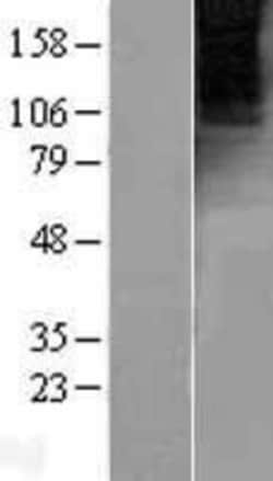 Novus Biologicals&trade;&nbsp;mGluR4 Overexpression Lysate