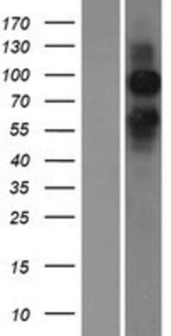 Novus Biologicals&trade;&nbsp;mGluR6 Overexpression Lysate