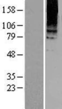 Novus Biologicals&trade;&nbsp;mGluR8 Overexpression Lysate