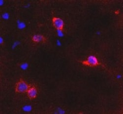 mGluR6 Antibody, Novus Biologicals:Antibodies:Primary Antibodies