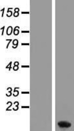 Novus Biologicals Metallothionein-1F Overexpression Lysate 0.1 mg | Buy Online | Novus Biologicals&trade; | Fisher Scientific