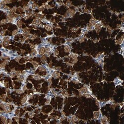 Metaxin 1 Antibody, Novus Biologicals 0.1mL; Unlabeled:Antibodies, Polyclonal