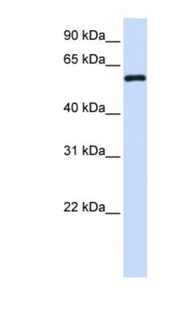 Metaxin 1 Antibody, Novus Biologicals 0.05mg; Unlabeled:Antibodies, Polyclonal