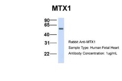 Metaxin 1 Antibody, Novus Biologicals 0.05mg; Unlabeled:Antibodies, Polyclonal
