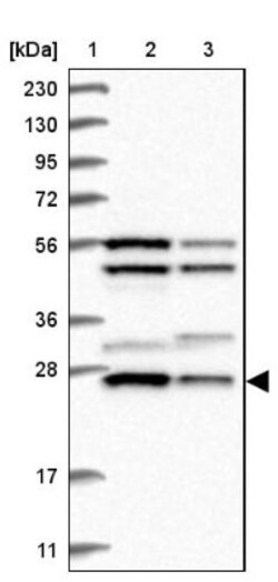 Metaxin-2 Antibody, Novus Biologicals:Antibodies:Primary Antibodies