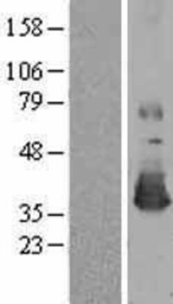 Novus Biologicals&trade;&nbsp;Methionine Sulfoxide Reductase A Overexpression Lysate