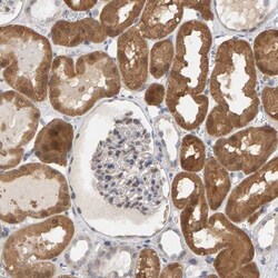 Methionine Sulfoxide Reductase A Antibody, Novus Biologicals 0.1mL; Unlabeled:Antibodies,