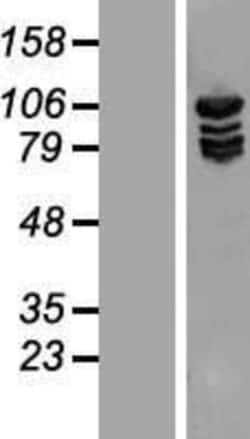 Novus Biologicals&trade;&nbsp;Methionyl tRNA synthetase Overexpression Lysate