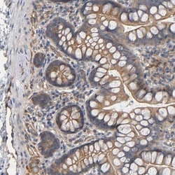 Methionyl tRNA synthetase Antibody, Novus Biologicals 25 &mu;L; Unlabeled:Antibodies,