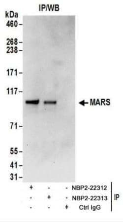 Methionyl tRNA synthetase Antibody, Novus Biologicals 0.1mg; Unlabeled:Antibodies,