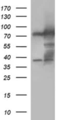 Methylmalonyl Coenzyme A mutase Antibody (OTI2C8), Novus Biologicals 0.1mL;