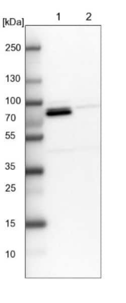 Methylmalonyl Coenzyme A mutase Antibody, Novus Biologicals 25 &mu;L; Unlabeled:Antibodies,