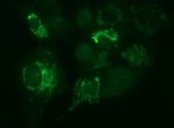 Methylmalonyl Coenzyme A mutase Antibody (OTI2C8), Novus Biologicals 0.1mL;