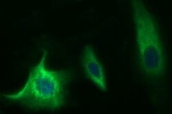 Methylmalonyl Coenzyme A mutase Antibody (OTI2C8), Novus Biologicals 0.1mL;