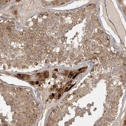 Methylmalonyl Coenzyme A mutase Antibody, Novus Biologicals:Antibodies:Primary